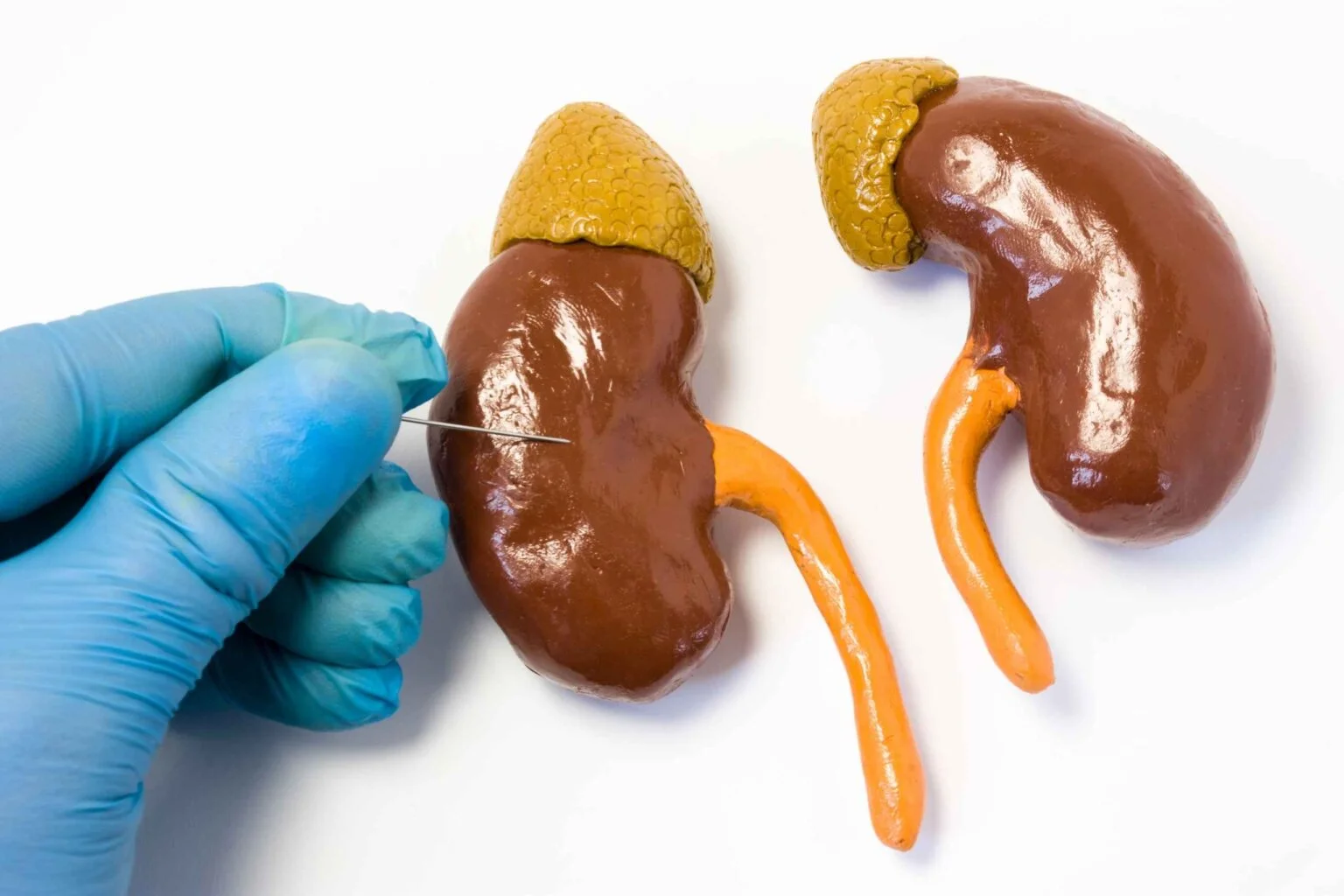 Kidney Model