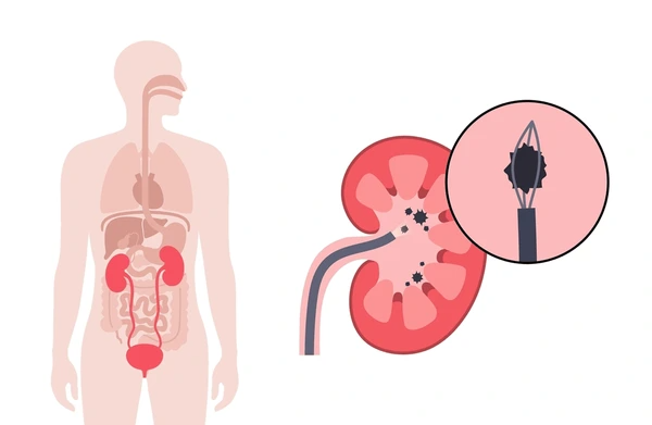 Kidney Image
